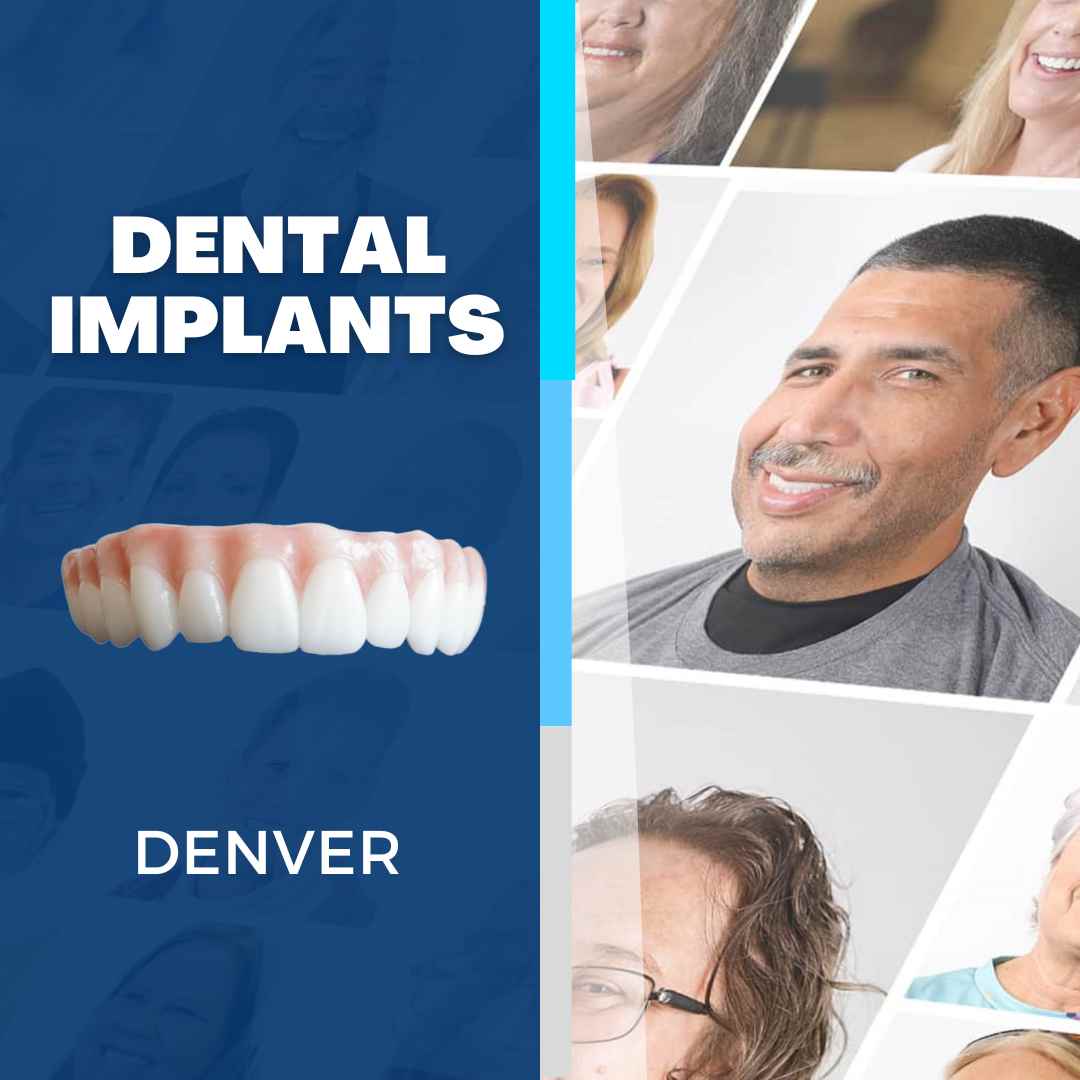 24 Hour Dental Implants Denver, CO Nuvia Dental Implant Center